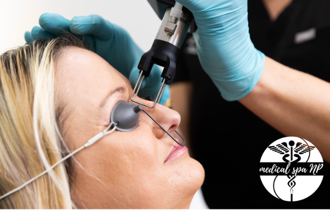 LASER RESURFACING! Cool Peel