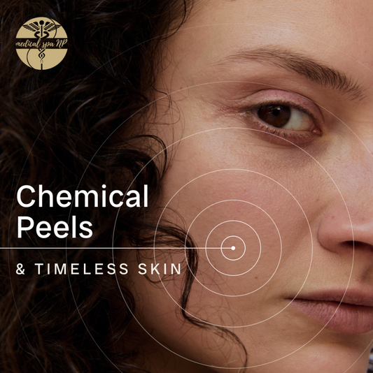 PEELS! Chemical Peel