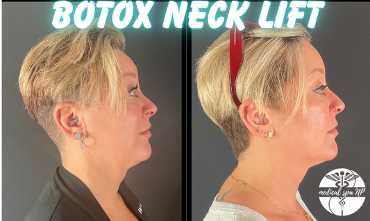 FREE AREA BOTOX! Smooth and Glow