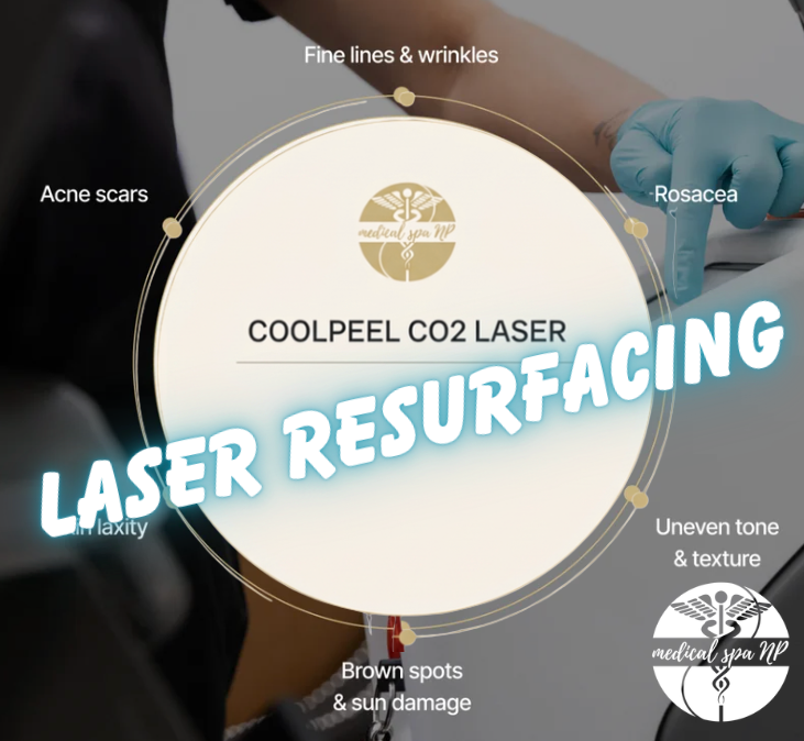 LASER RESURFACING! Cool Peel