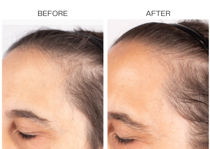 HAIR! Grow and Glow Bundle