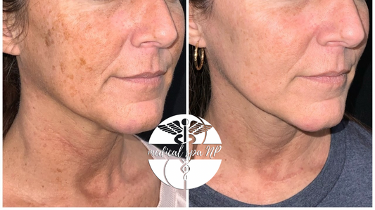 SUN SPOTS! Pigment Perfection Bundle